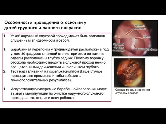 Особенности проведения отоскопии у детей грудного и раннего возраста: Узкий наружный слуховой