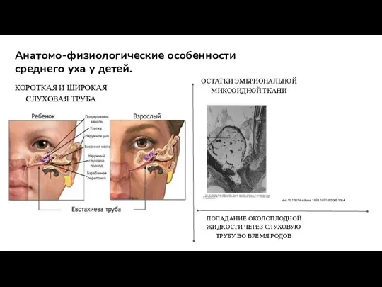 Анатомо-физиологические особенности среднего уха у детей. КОРОТКАЯ И ШИРОКАЯ СЛУХОВАЯ ТРУБА ОСТАТКИ