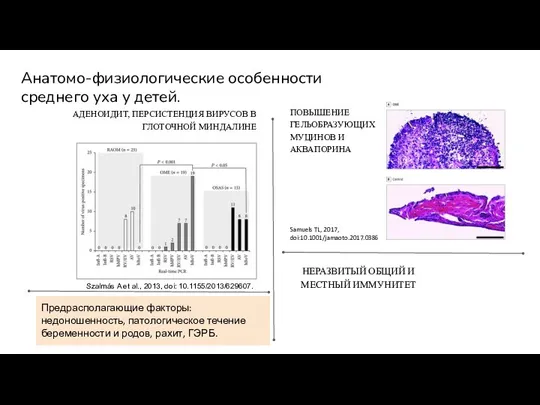 Анатомо-физиологические особенности среднего уха у детей. АДЕНОИДИТ, ПЕРСИСТЕНЦИЯ ВИРУСОВ В ГЛОТОЧНОЙ МИНДАЛИНЕ