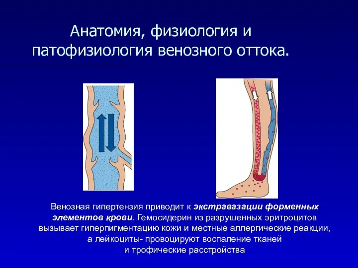 Анатомия, физиология и патофизиология венозного оттока. Венозная гипертензия приводит к экстравазации форменных