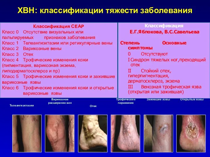 Классификация СЕАР Класс 0 Отсутствие визуальных или пальпируемых признаков заболевания Класс 1