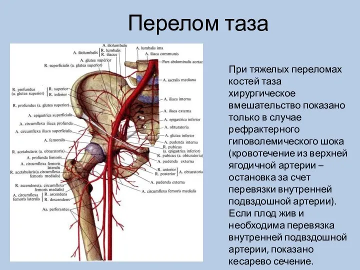 Перелом таза При тяжелых переломах костей таза хирургическое вмешательство показано только в