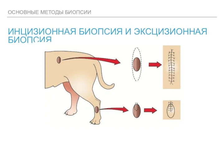 ОСНОВНЫЕ МЕТОДЫ БИОПСИИ ИНЦИЗИОННАЯ БИОПСИЯ И ЭКСЦИЗИОННАЯ БИОПСИЯ