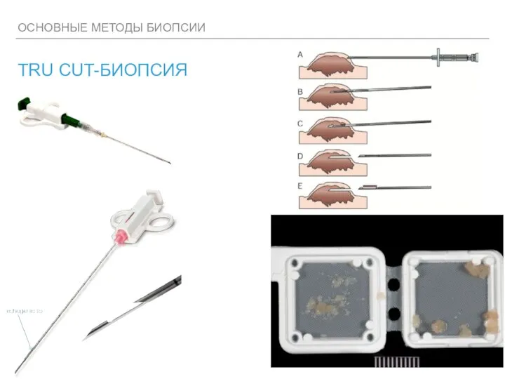 ОСНОВНЫЕ МЕТОДЫ БИОПСИИ TRU CUT-БИОПСИЯ