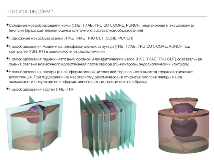 ЧТО ИССЛЕДУЕМ? Солидные новообразования кожи (ТИБ, ТИАБ, TRU CUT, CORE, PUNCH, инцизионная