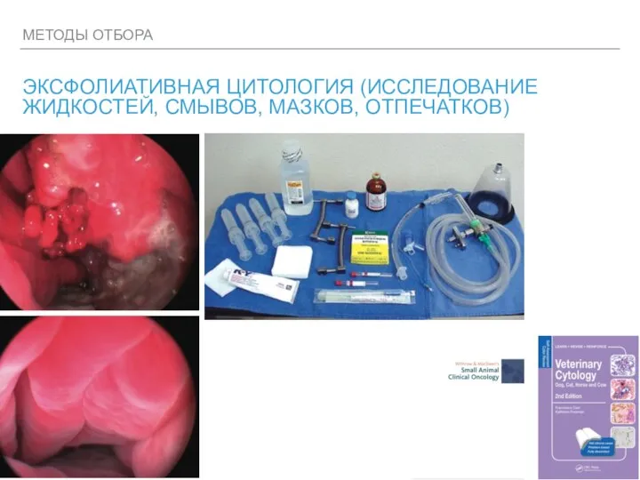 МЕТОДЫ ОТБОРА ЭКСФОЛИАТИВНАЯ ЦИТОЛОГИЯ (ИССЛЕДОВАНИЕ ЖИДКОСТЕЙ, СМЫВОВ, МАЗКОВ, ОТПЕЧАТКОВ)