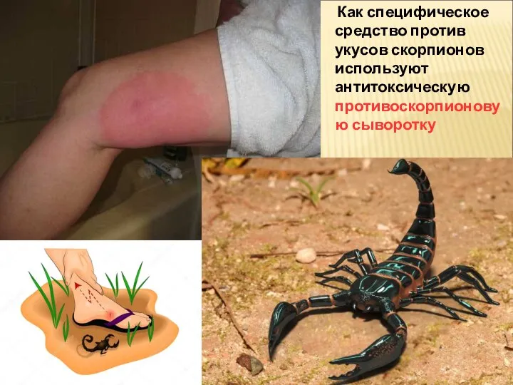 Как специфическое средство против укусов скорпионов используют антитоксическую противоскорпионовую сыворотку