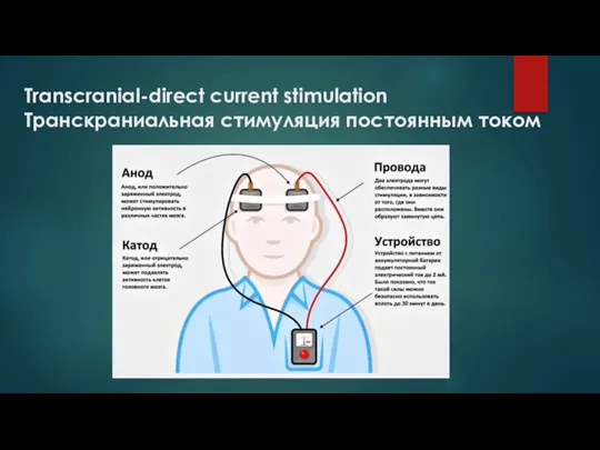 Transcranial-direct current stimulation Транскраниальная стимуляция постоянным током