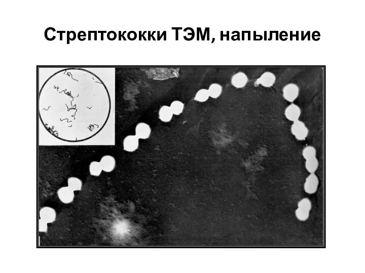 Стрептококки ТЭМ, напыление