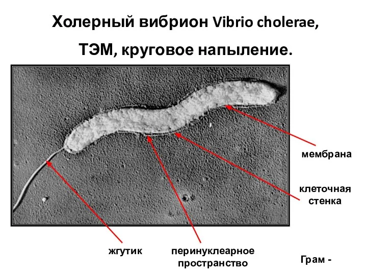 Холерный вибрион Vibrio cholerae, ТЭМ, круговое напыление. жгутик клеточная стенка Грам - перинуклеарное пространство мембрана
