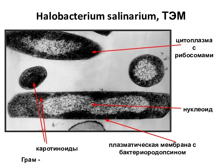 Halobacterium salinarium, ТЭМ каротиноиды нуклеоид цитоплазма с рибосомами плазматическая мембрана с бактериородопсином Грам -