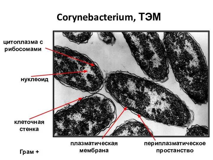 Corynebacterium, ТЭМ клеточная стенка периплазматическое простанство плазматическая мембрана нуклеоид цитоплазма с рибосомами Грам +