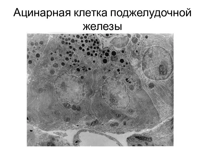 Ацинарная клетка поджелудочной железы