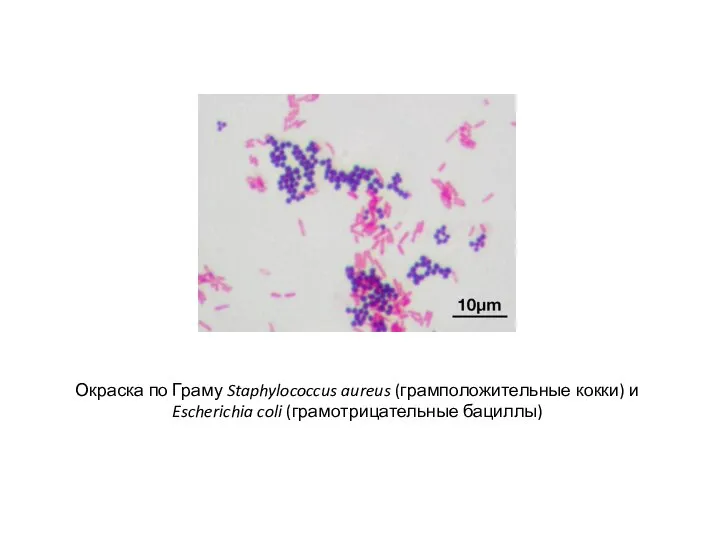 Окраска по Граму Staphylococcus aureus (грамположительные кокки) и Escherichia coli (грамотрицательные бациллы)