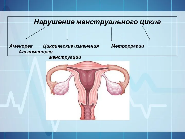 Нарушение менструального цикла Аменорея Циклические изменения Метроррагии Альгоменорея менструации