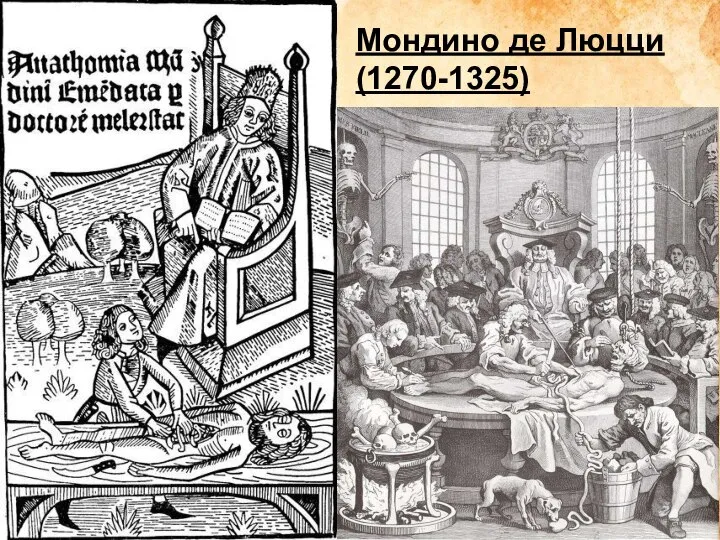 Мондино де Люцци (1270-1325) руководит вскрытием.