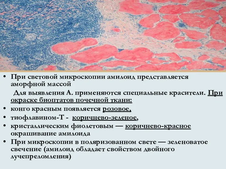 При световой микроскопии амилоид представляется аморфной массой Для выявления А. применяются специальные