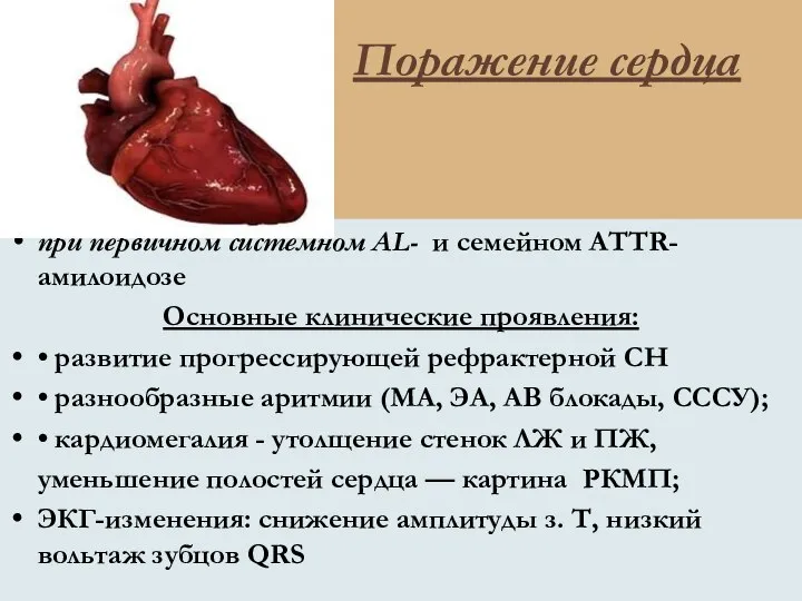 Поражение сердца при первичном системном AL- и семейном ATTR-амилоидозе Основные клинические проявления: