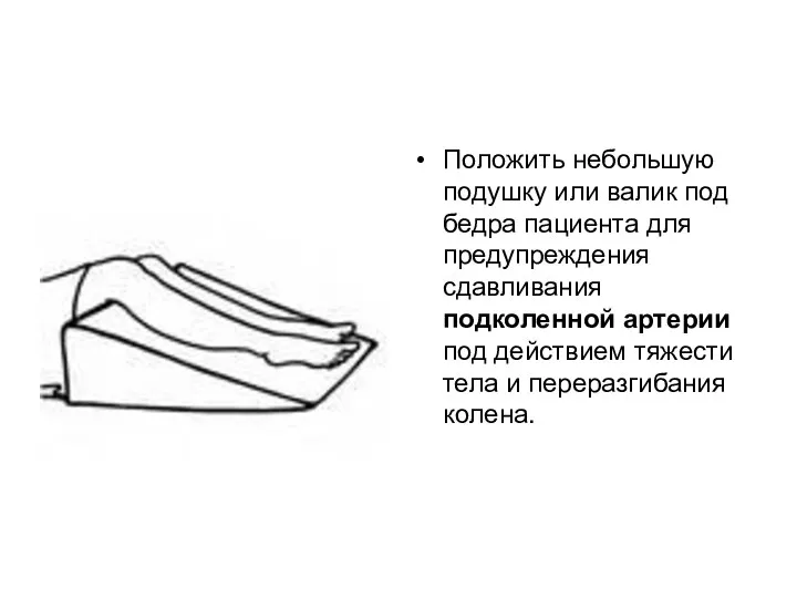 Положить небольшую подушку или валик под бедра пациента для предупреждения сдавливания подколенной
