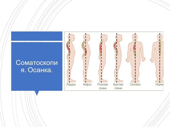 Соматоскопия. Осанка.