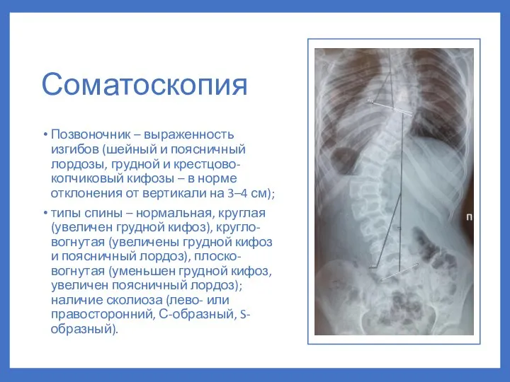 Соматоскопия Позвоночник – выраженность изгибов (шейный и поясничный лордозы, грудной и крестцово-копчиковый