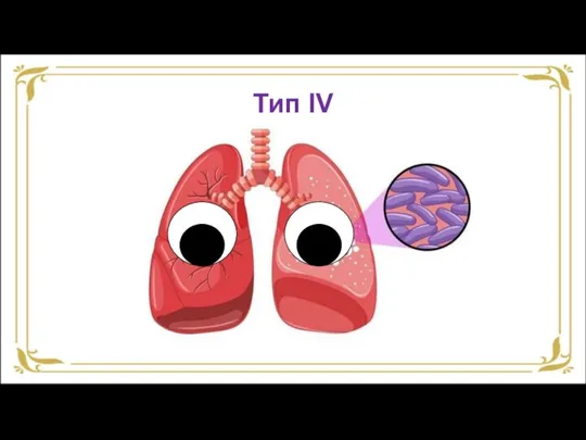 Тип IV