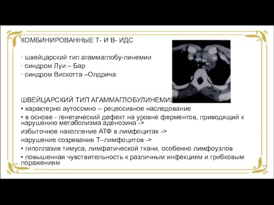 КОМБИНИРОВАННЫЕ Т- И В- ИДС · швейцарский тип агаммаглобу-линемии · синдром Луи