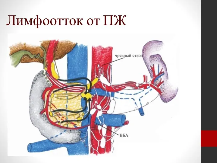 Лимфоотток от ПЖ