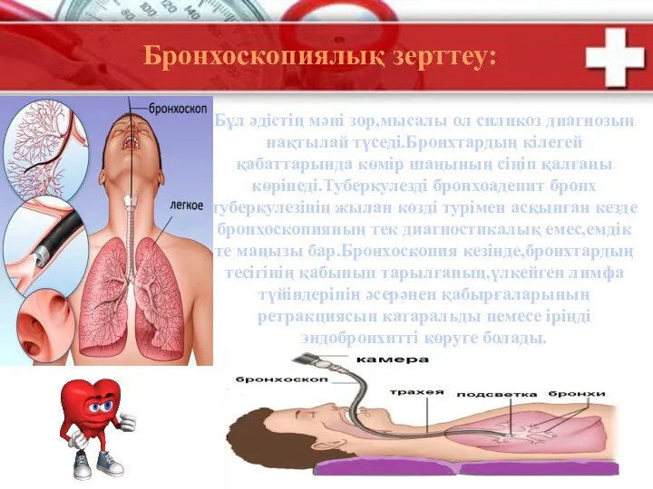 Бронхоскопиялық зерттеу: Бұл әдістің мәні зор,мысалы ол силикоз диагнозын нақтылай түседі.Бронхтардың кілегей