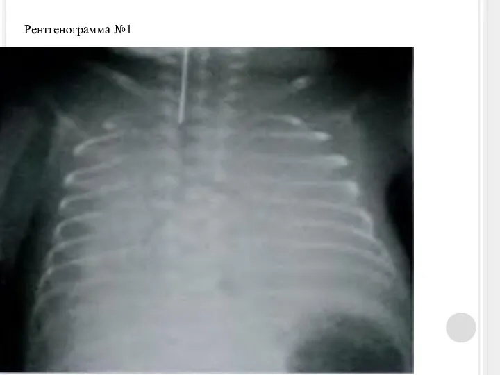 Рентгенограмма №1