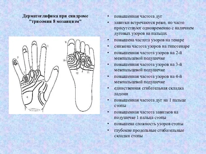 Дерматоглифика при синдроме "трисомии 8 мозаицизм" повышенная частота дуг завитки встречаются реже,