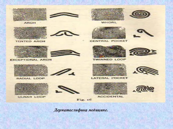 Дерматоглифика медицине.