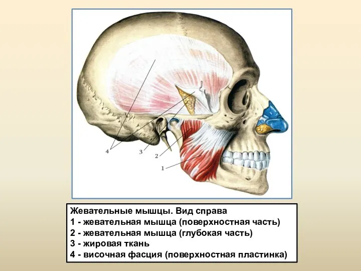 Жевательные мышцы. Вид справа 1 - жевательная мышца (поверхностная часть) 2 -