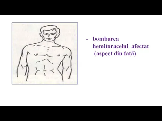 bombarea hemitoracelui afectat (aspect din față)