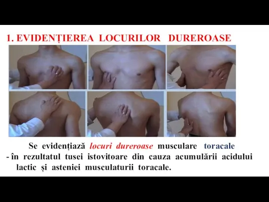 1. EVIDENȚIEREA LOCURILOR DUREROASE Se evidențiază locuri dureroase musculare toracale - în