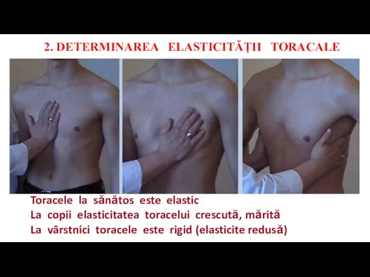 2. DETERMINAREA ELASTICITĂȚII TORACALE Toracele la sănătos este elastic La copii elasticitatea