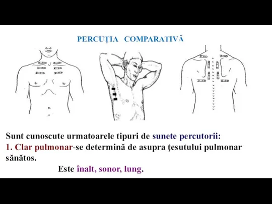 PERCUȚIA COMPARATIVĂ Sunt cunoscute urmatoarele tipuri de sunete percutorii: 1. Clar pulmonar-se