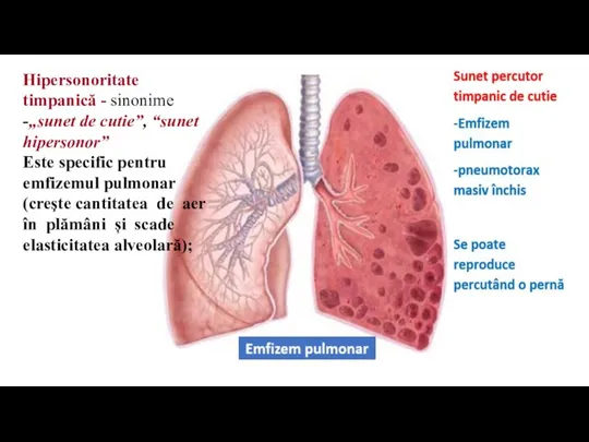 Hipersonoritate timpanică - sinonime -„sunet de cutie”, “sunet hipersonor” Este specific pentru