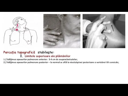 Percuţia topografică stabileşte: I. Limitele superioare ale plămânilor 1.) Înălţimea apexurilor pulmonare