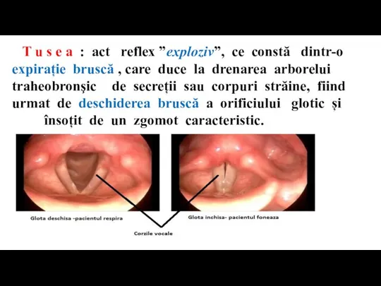 T u s e a : act reflex ”exploziv”, ce constă dintr-o