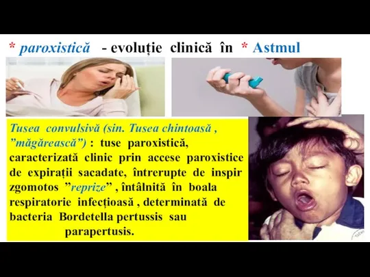 Tusea convulsivă (sin. Tusea chintoasă , ”măgărească”) : tuse paroxistică, caracterizată clinic