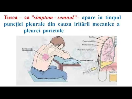 Tusea – ca ”simptom - semnal”– apare în timpul puncției pleurale din