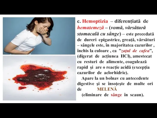 c. Hemoptizia – diferențiată de hematemeză – (vomă, vărsătură stomacală cu sânge)