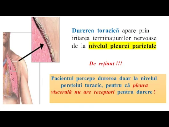 Durerea toracică apare prin iritarea terminațiunilor nervoase de la nivelul pleurei parietale