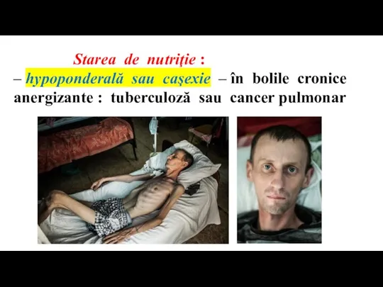 Starea de nutriţie : – hypoponderală sau caşexie – în bolile cronice