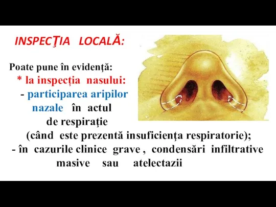 INSPECŢIA LOCALĂ: Poate pune în evidenţă: * la inspecția nasului: - participarea