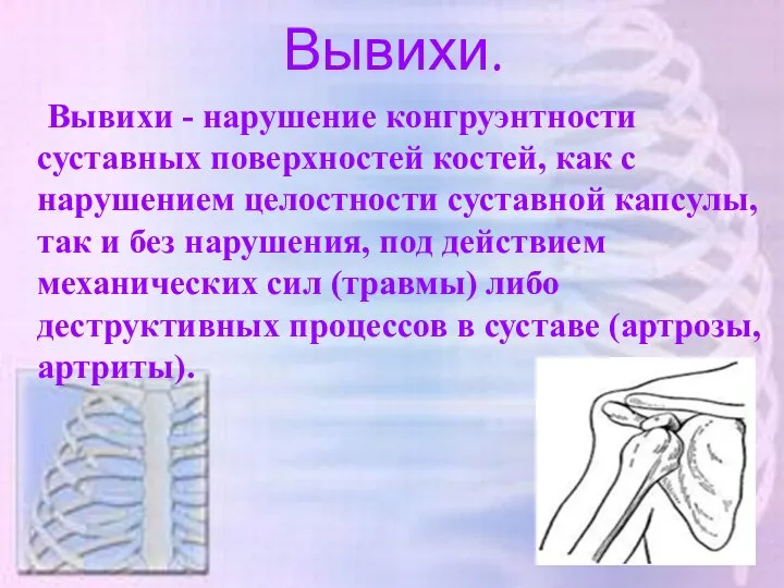 Вывихи. Вывихи - нарушение конгруэнтности суставных поверхностей костей, как с нарушением целостности