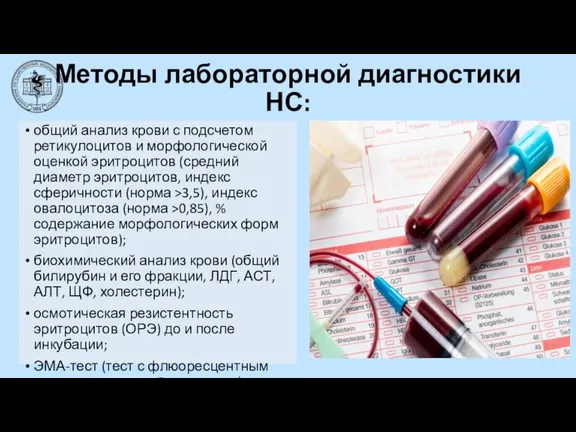 Методы лабораторной диагностики НС: общий анализ крови с подсчетом ретикулоцитов и морфологической