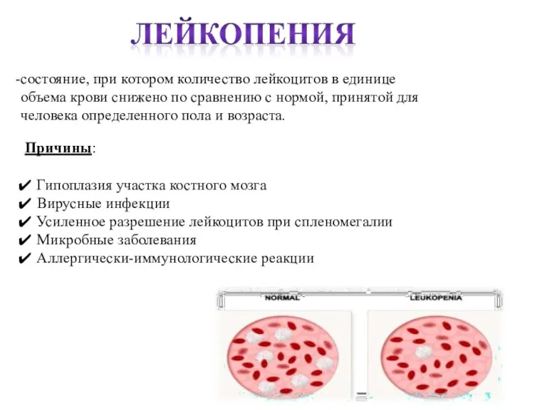 состояние, при котором количество лейкоцитов в единице объема крови снижено по сравнению