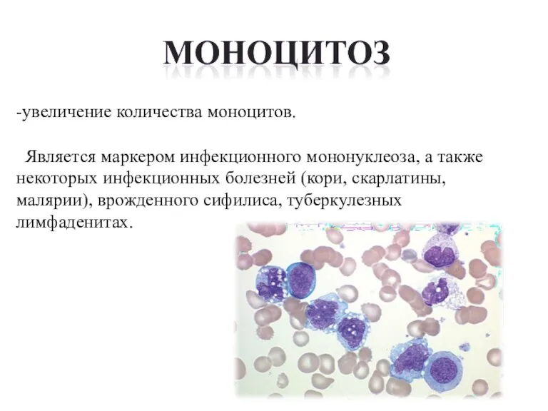 -увеличение количества моноцитов. Является маркером инфекционного мононуклеоза, а также некоторых инфекционных болезней